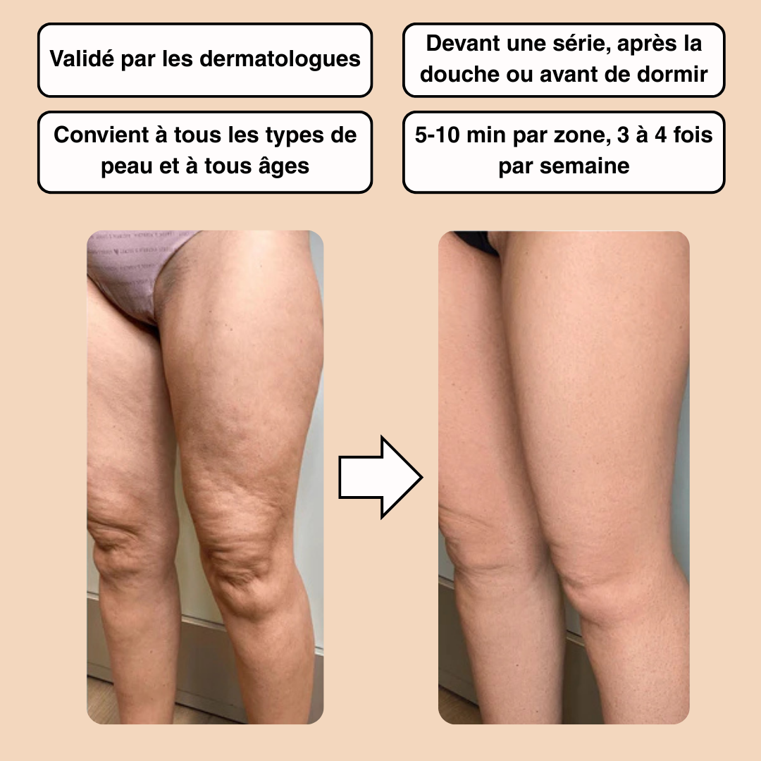 Masseur Anticellulite Nerah